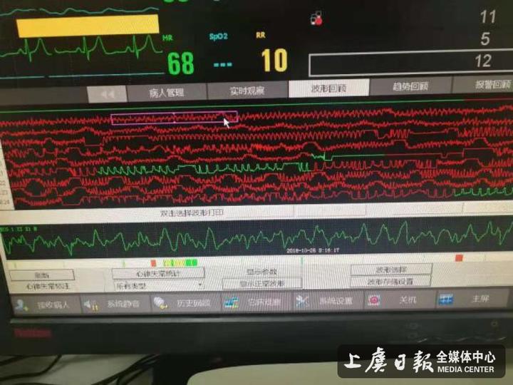 心电监护提示:室颤.jpg