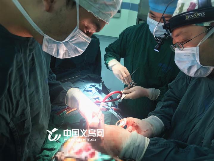浙大四院首例微创心脏瓣膜手术开启义乌心脏手术微创时代