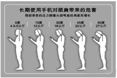 低头族颈椎承受可怕压力,为了撑住我们的脑袋,它们也是拼了