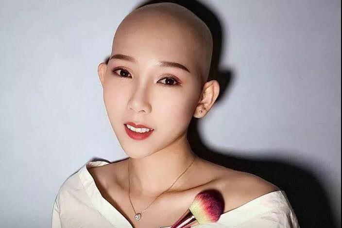 淘宝光头美女主播:掉光头发后 我的美丽才开始绽放