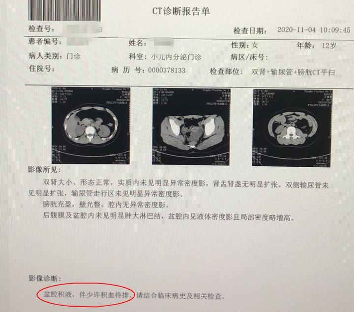 "黄体破裂"听说过吗?12岁女孩腹痛难忍,竟是这个原因!