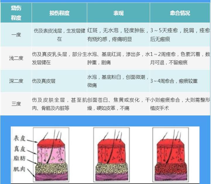 如何正确抵御南方的"湿冷魔法攻击"?这些技能快抱走