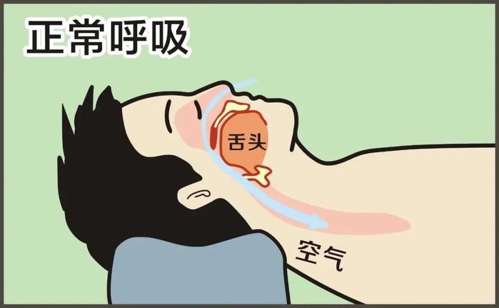 呼呼呼~~~你身边有鼾声如雷的"雷震子"吗?