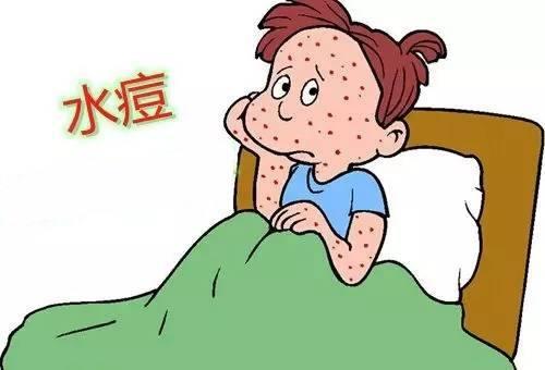 水痘具有高度传染性_水痘进入高发时期_全国进入水痘高发期